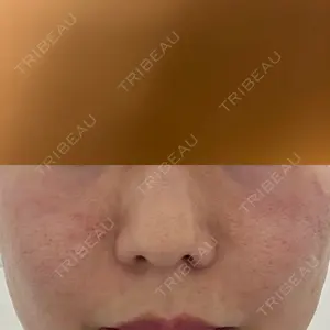 ライズワン美容皮膚科クリニック口コミ