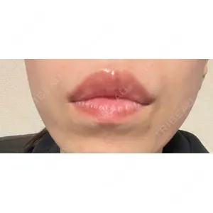口コミ