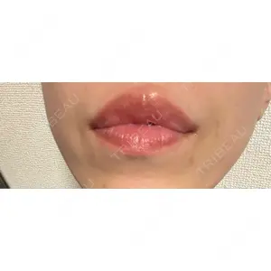 口コミ