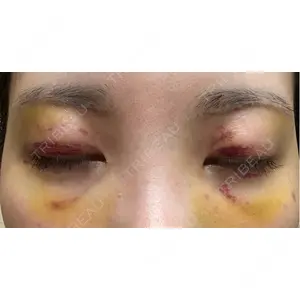PRO CLINIC プロクリニック 銀座院口コミ