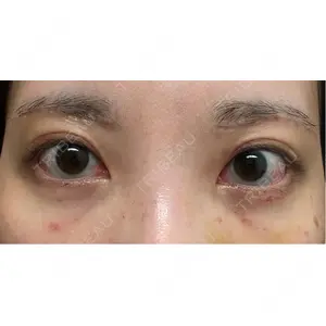 PRO CLINIC プロクリニック 銀座院口コミ