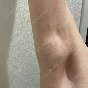 共立美容外科 浜松院口コミ