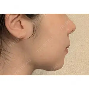口コミ