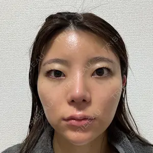 口コミ
