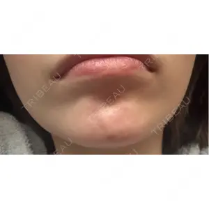 口コミ