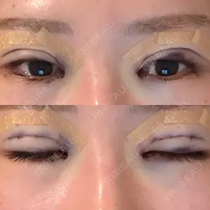 LUHO（ルホ）美容外科口コミ