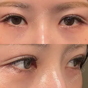 LUHO（ルホ）美容外科口コミ