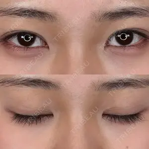 アリエル美容クリニック アリエル美容クリニック 大宮院口コミ