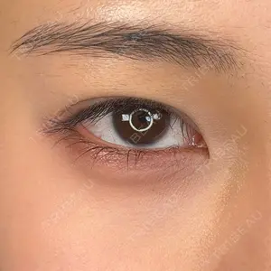 アリエル美容クリニック アリエル美容クリニック 大宮院口コミ