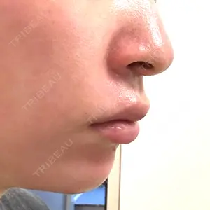 ルラ美容クリニック ルラ美容クリニック 渋谷本院口コミ
