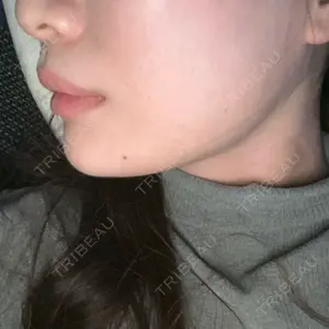 フィラークリニック フィラークリニック 名古屋栄院口コミ