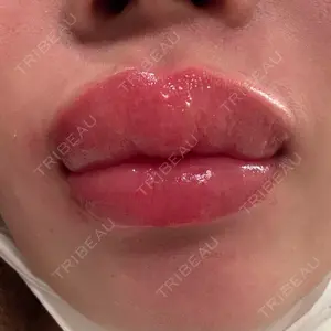BiBiクリニック口コミ