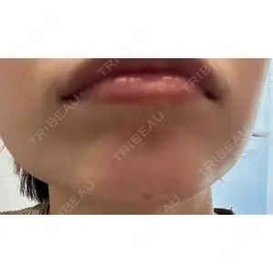 口コミ