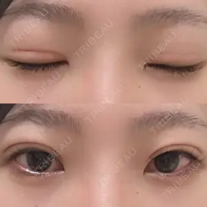 口コミ