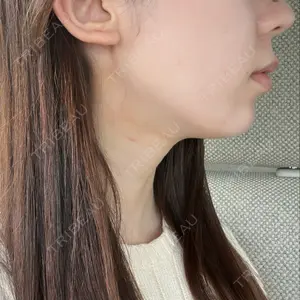 口コミ