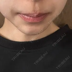 口コミ