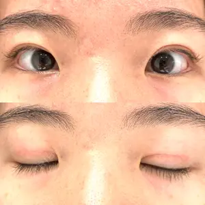 東京BELLEZZAクリニック口コミ