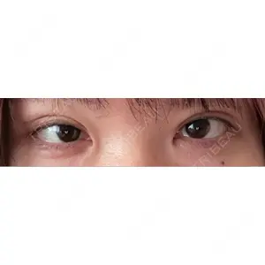 LUHO（ルホ）美容外科口コミ
