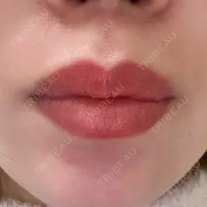 BiBiクリニック口コミ