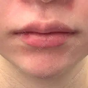 ルラ美容クリニック ルラ美容クリニック 渋谷本院口コミ