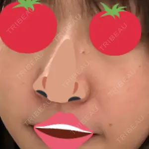 聖心美容クリニック グループ S-Laboクリニック 渋谷院口コミ