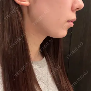 口コミ