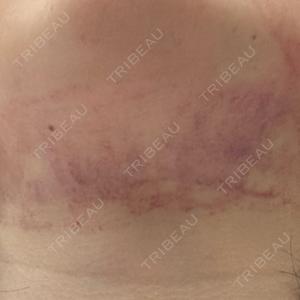 PureMe Skin Clinic（ピュアミースキンクリニック麻布）口コミ