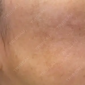 ルラ美容クリニック ルラ美容クリニック 広島院口コミ