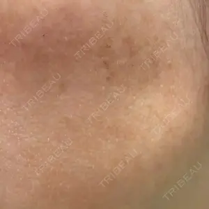 ルラ美容クリニック ルラ美容クリニック 広島院口コミ