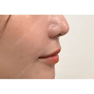 口コミ