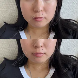 口コミ