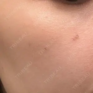 L‘amour clinic Tokyo【ラムールクリニック東京】口コミ