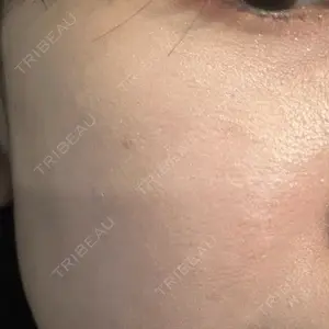 L‘amour clinic Tokyo【ラムールクリニック東京】口コミ