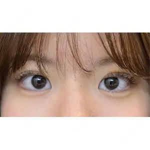 湘南美容クリニック 池袋東口院の