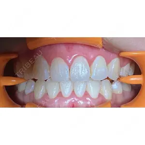 アンデルト歯科・矯正歯科口コミ