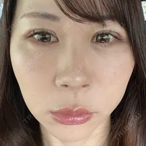 HAAB×DREAM BEAUTY CLINIC HAAB×DREAM BEAUTY CLINIC 大阪梅田院口コミ