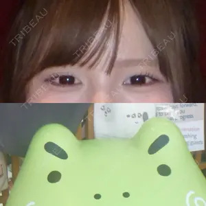 HAAB×DREAM BEAUTY CLINIC 大阪梅田院の