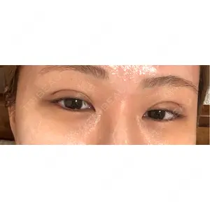 口コミ