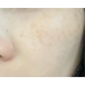 ルラ美容クリニック ルラ美容クリニック 新宿院口コミ
