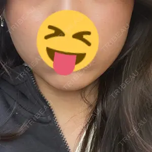 DMTC美容皮膚科 DMTC美容皮膚科 日本橋院口コミ