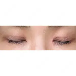 AI Beauty Clinic （エーアイ美容クリニック）口コミ