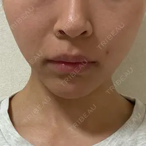 口コミ