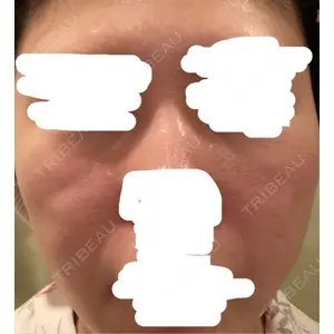 ミニマムスキンクリニック ミニマムスキンクリニック池袋口コミ