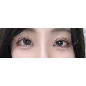 口コミ