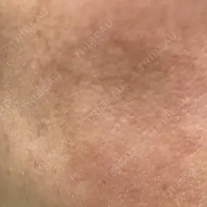 ルラ美容クリニック ルラ美容クリニック 広島院口コミ