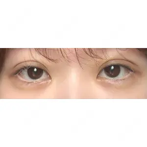 HAAB×DREAM BEAUTY CLINIC HAAB×DREAM BEAUTY CLINIC 大阪梅田院口コミ