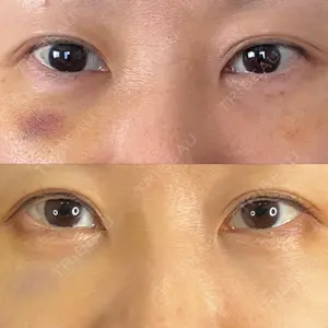 藤・ナチュレ美容クリニック 藤・ナチュレ美容クリニック 銀座院口コミ