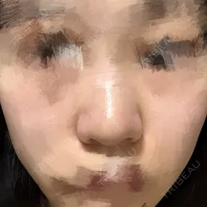リッツ美容外科 大阪院口コミ