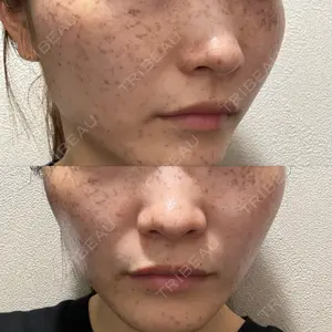 東京美容クリニックの口コミ