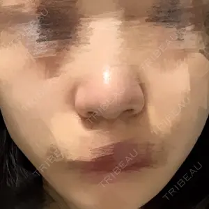 リッツ美容外科 大阪院口コミ